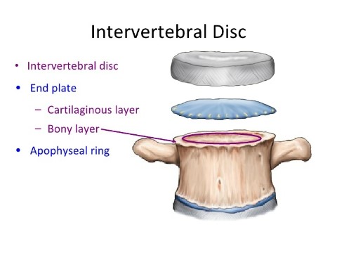 [디스크] 디스크(추간판)는 무엇인가? : 네이버 블로그