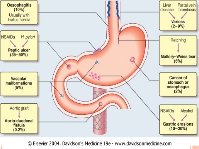 gastrointestinal-bleeding